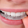 Invisalign