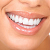 Zoom! Teeth Whitening